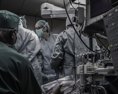 Lekárom v USA sa podarila transplantácia obličky od darcu ktorý je pozitívny na HIV