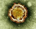 Na Slovensku sa koronavírus zatiaľ nevyskytuje