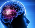 Spoločnosť Blackrock Neurotech implantovala 50 ľuďom mozgové čipy na liečbu slepoty hluchoty a depresie