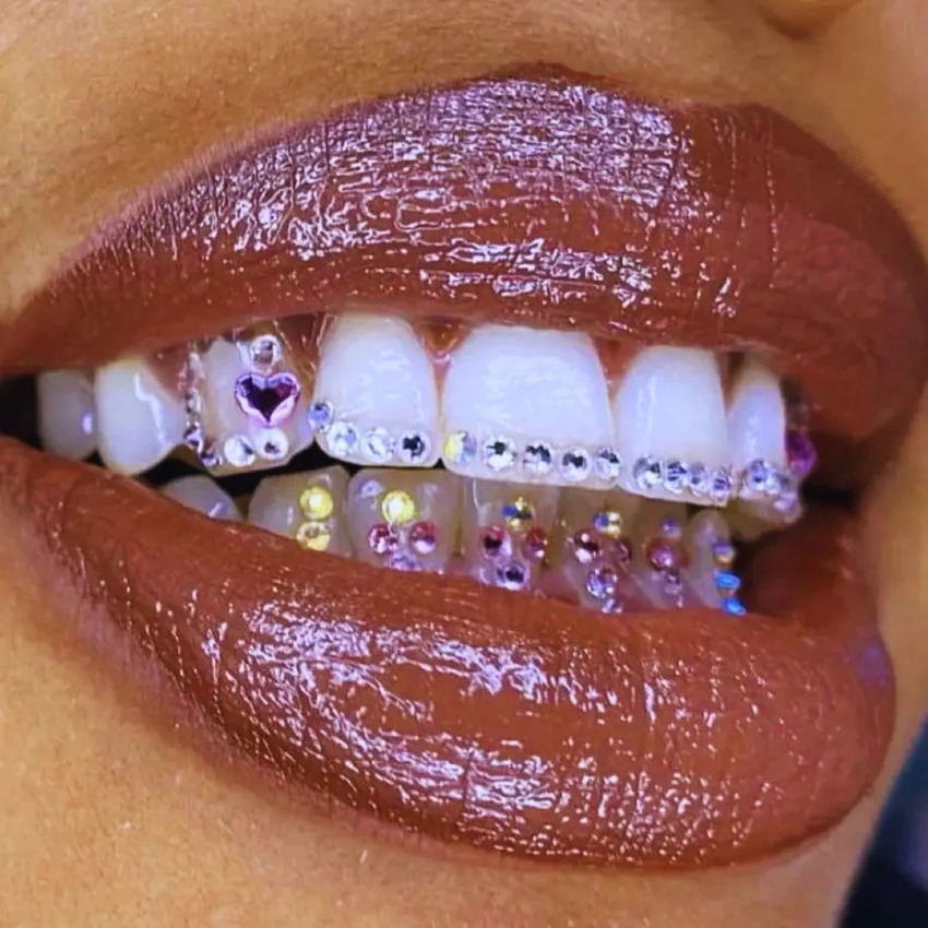 Tooth gems sú vyhotovené buď z plastu, skla, alebo z drahších materiálov ako zlato, biele zlato či pravé diamanty.