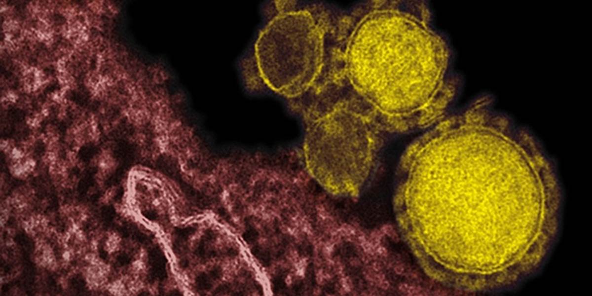 Na vírus MERS zomrelo už viac ako stovka ľudí