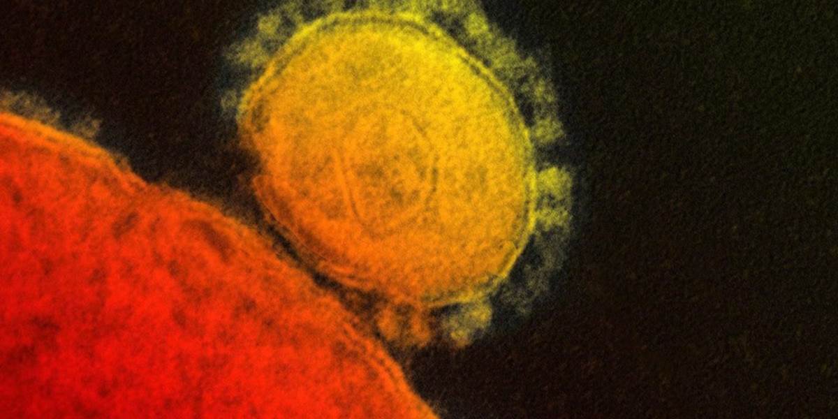 Hygiena môže pomôcť zabrániť šíreniu vírusu MERS
