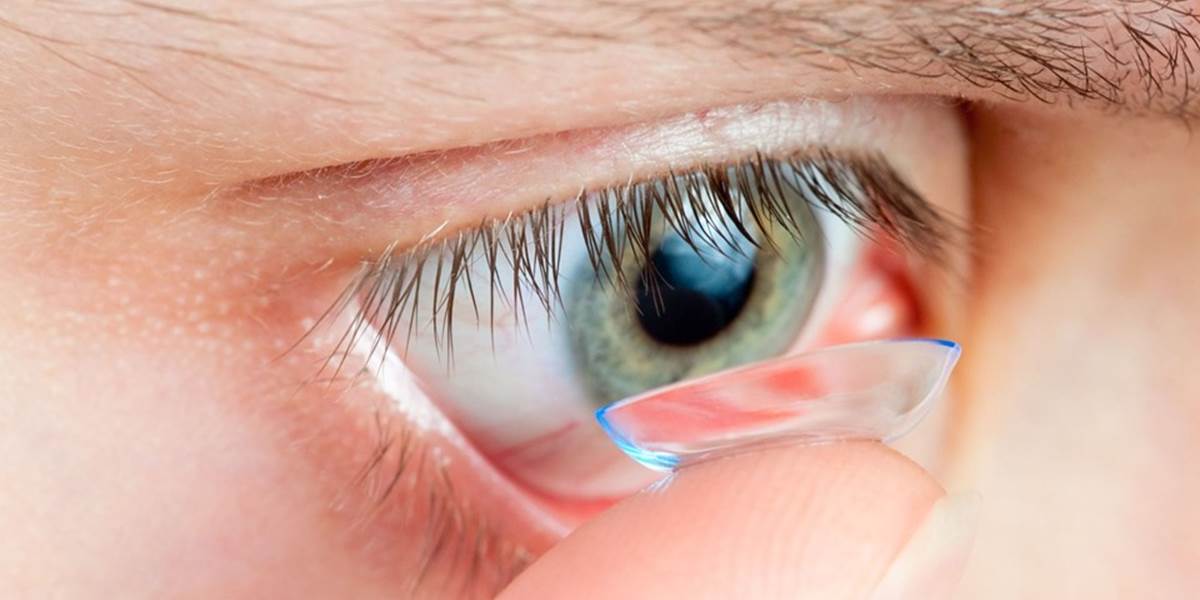 Žena si pol roka nečistila kontaktné šošovky, napokon oslepla!
