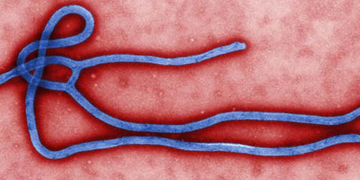Riziko, že epidémia eboly zachváti Maďarsko, je podľa experta mizivé