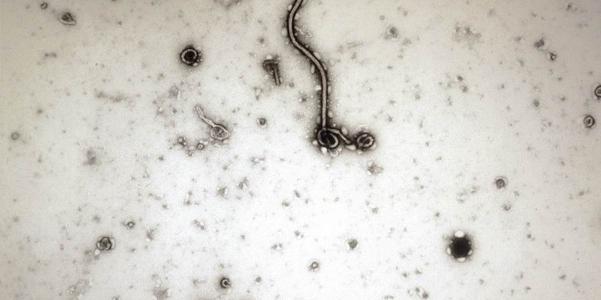 Epidémia eboly má už 961 obetí, infikovaných je najmenej 1779 ľudí