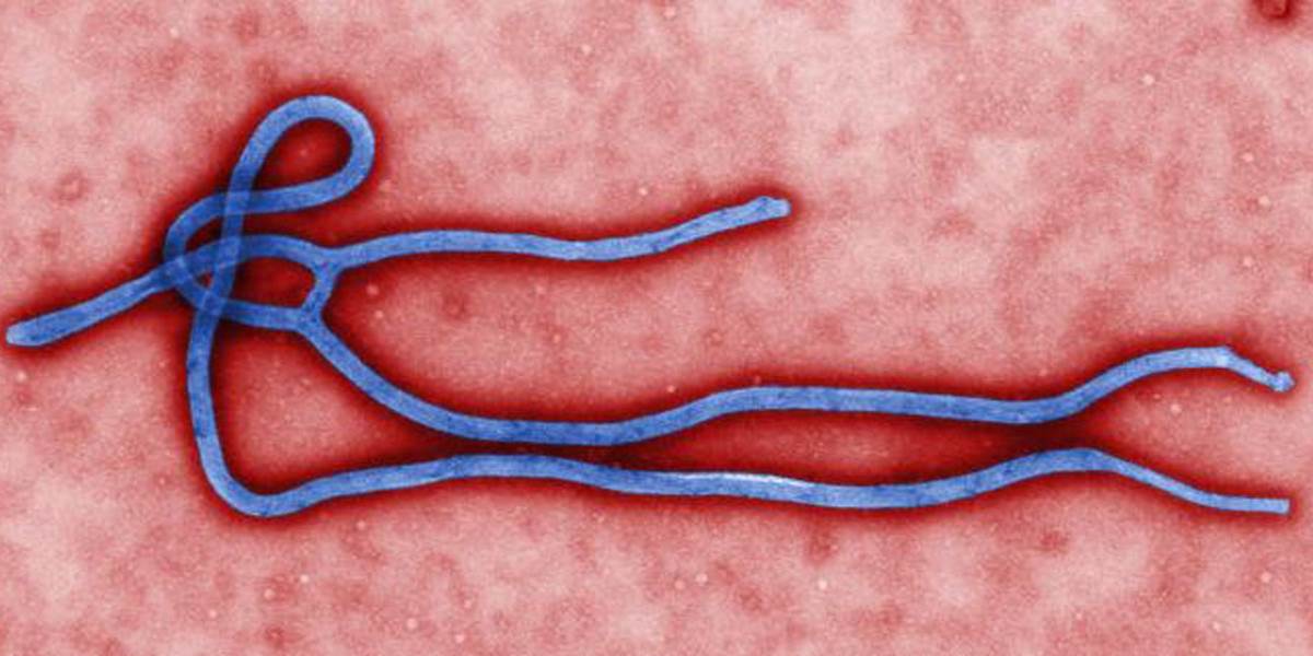 V Kanade hospitalizovali muža s príznakmi eboly
