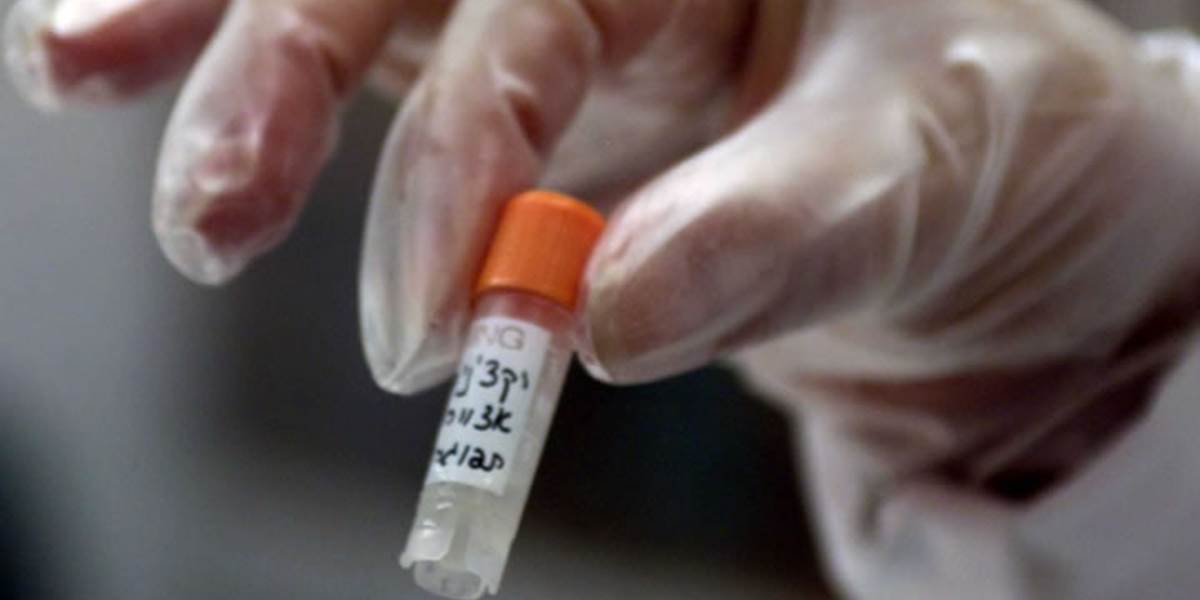 Do Libérie dorazil experimentálny liek na ebolu