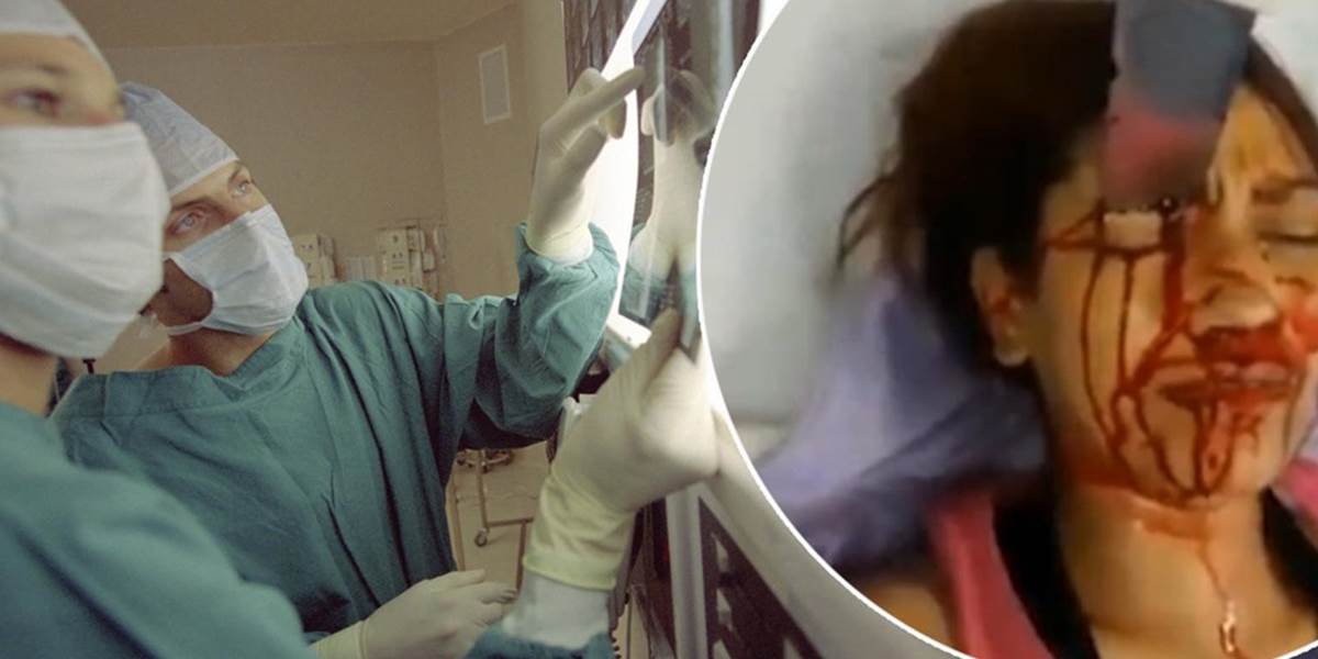 VIDEO Neuveriteľné: Žene zapichol expriateľ nôž do hlavy, prežila!