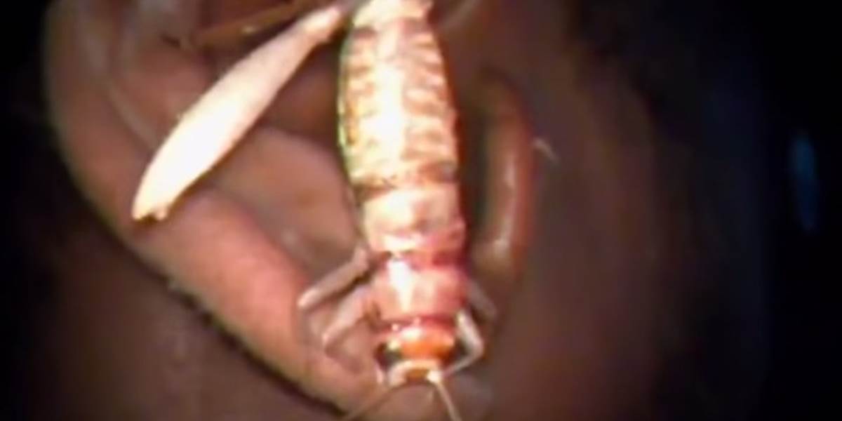 Nechutné VIDEO: Muža svrbelo v uchu, vytiahli mu odtiaľ päťcentimetrový hmyz!