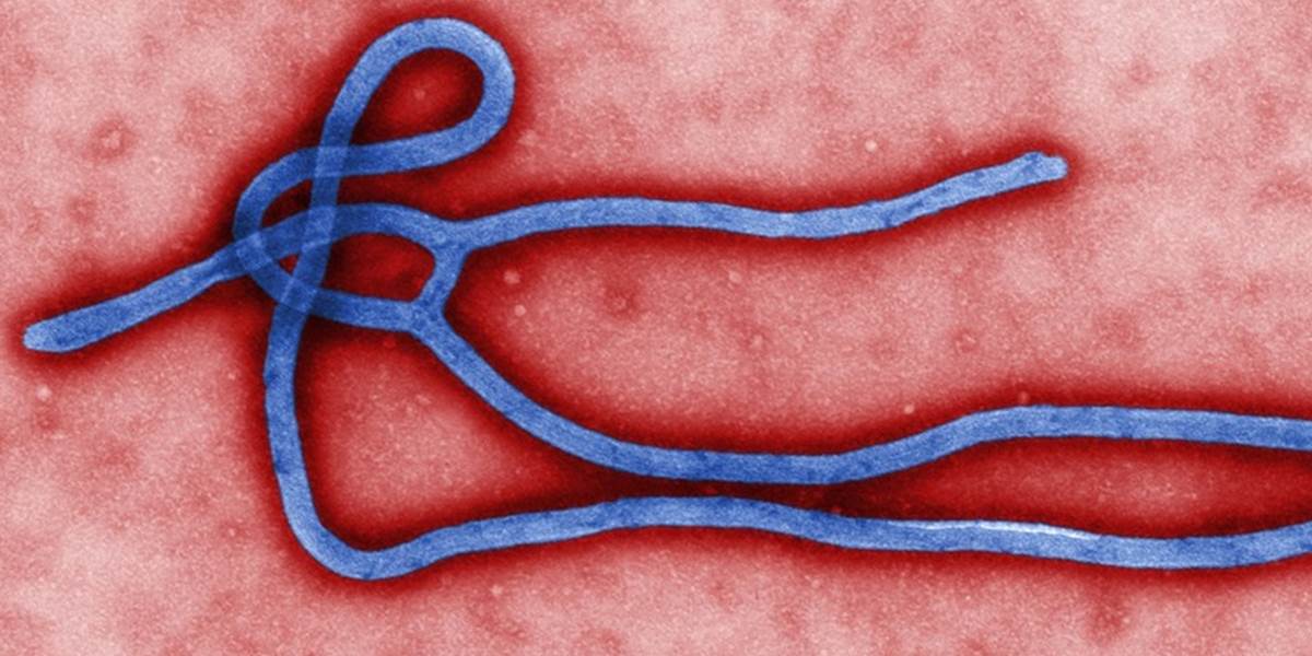 Ošetrovateľka v Texase sa nakazila ebolou ako prvá v USA