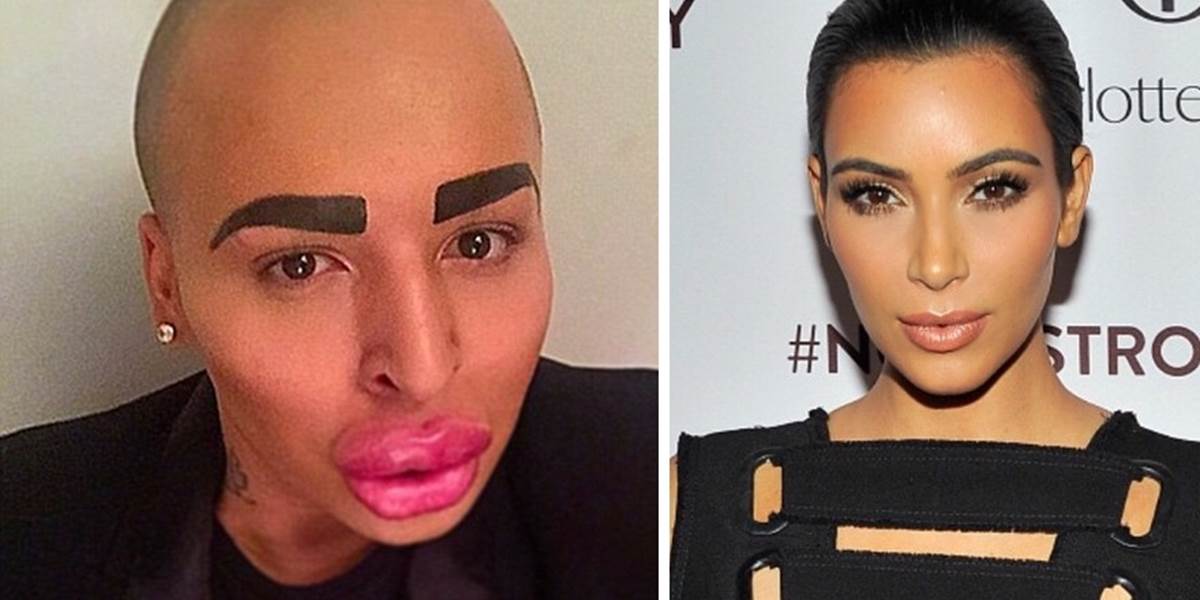 Mladík (23) minul 150-tisíc na plastické operácie: Chce vyzerať ako Kim Kardashian