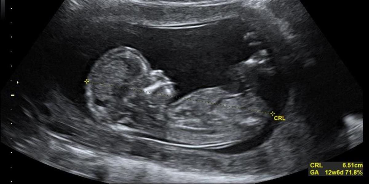 Choré: Feministka išla na potrat, pretože čakala chlapca