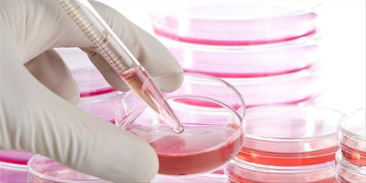 Liečba kmeňovými bunkami je už dostupná aj na Slovensku