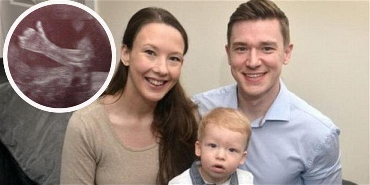 Rodičov prekvapila FOTO ich nenarodeného syna z ultrazvuku