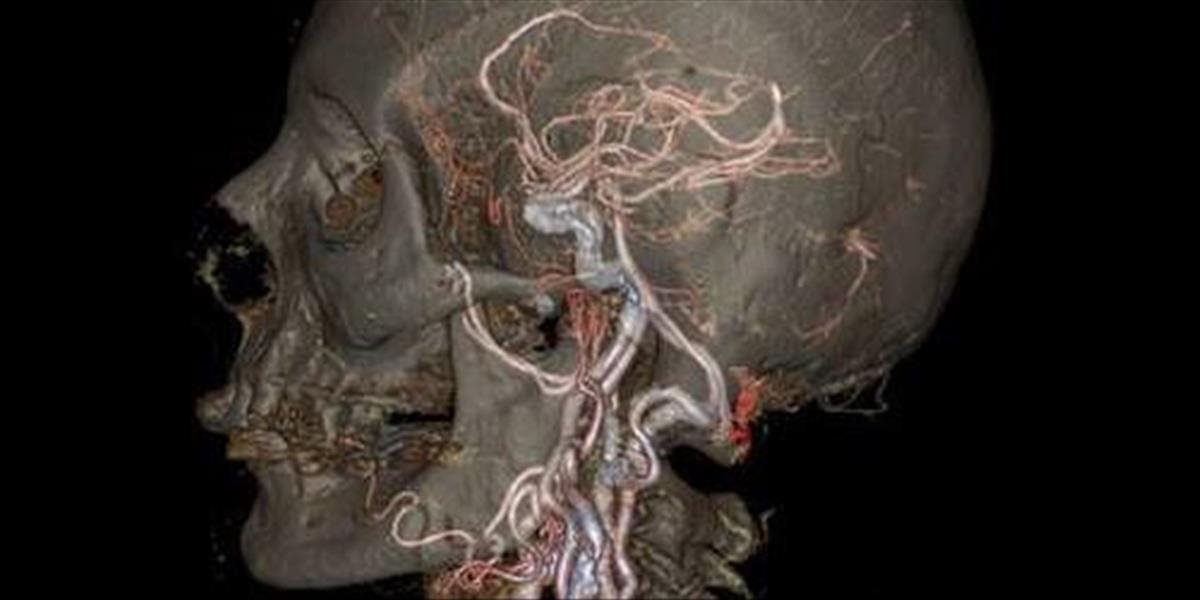 FOTO Prevratný objav pre medicínu: Revolučné CT dokáže zobraziť ľudské telo v HD