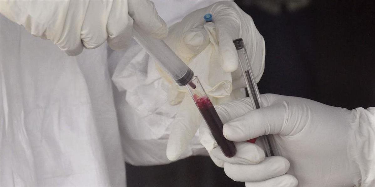 Chlapec, ktorý zomrel na ebolu, sa nakazil známym typom vírusu