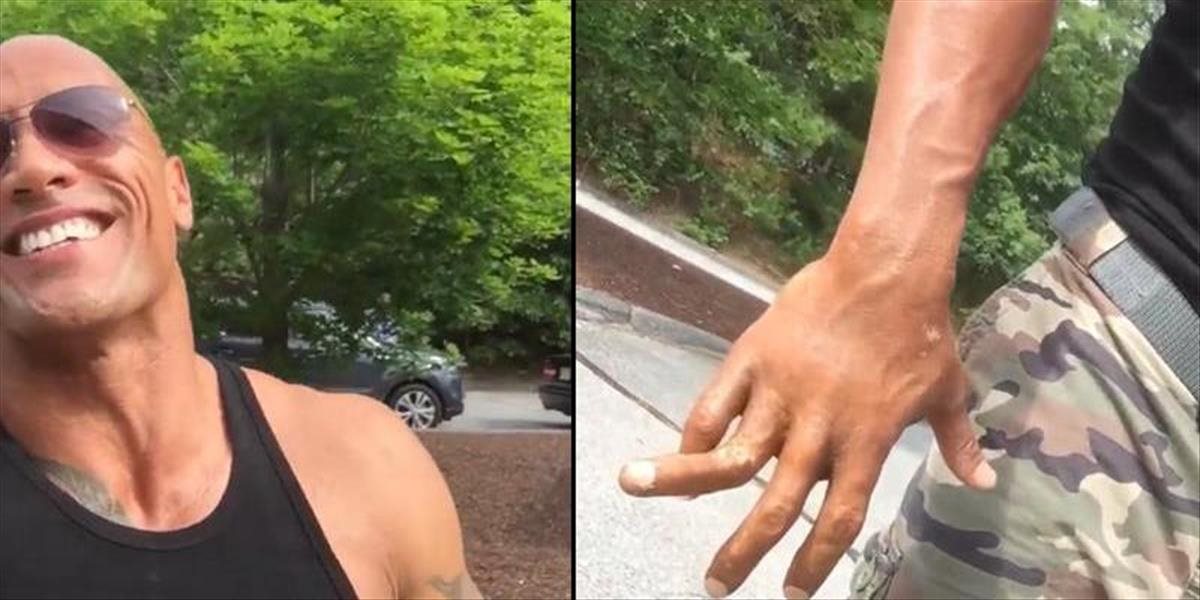 VIDEO Herec Dwayne Johnson je ozaj z kameňa: Smeje sa na svojom zlomenom prste