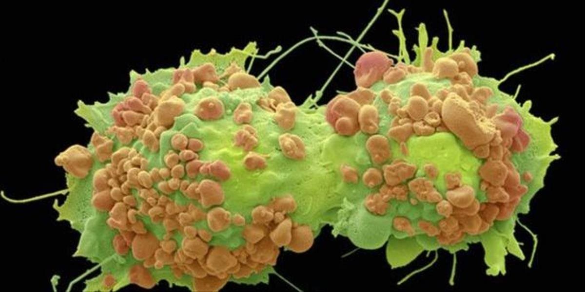 Americkí vedci objavili spôsob, ako zvrátiť tvorbu nádorov