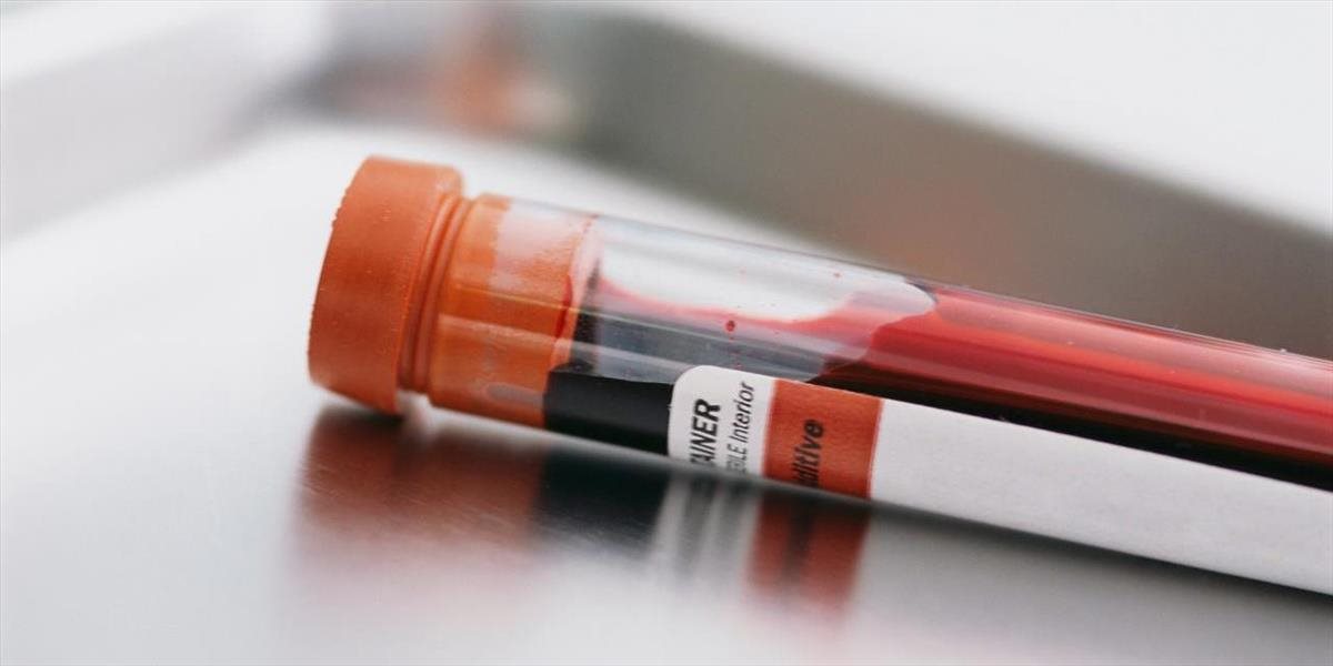 Opätovné prepuknutie rakoviny by mohol v predstihu odhaliť krvný test
