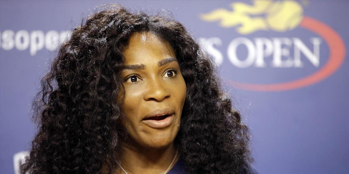 Serena: Ich rozhodnutie, ak chcú belošku s blond vlasmi