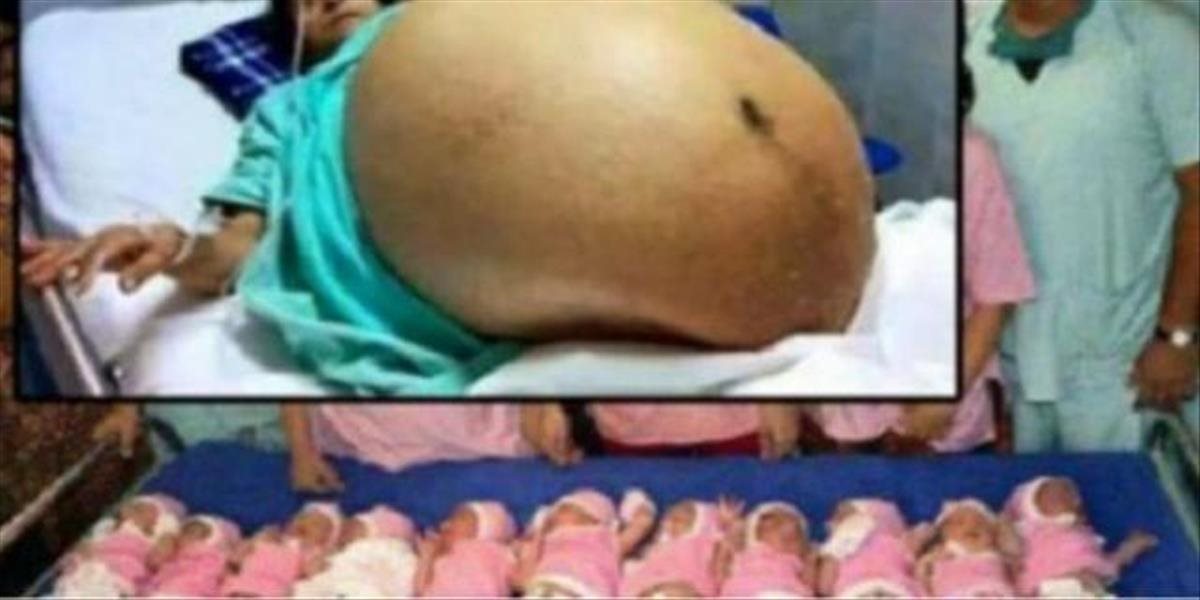 Zázrak prírody: Žena porodila 11 zdravých detí, zapíše sa do Guinessovej knihy rekordov