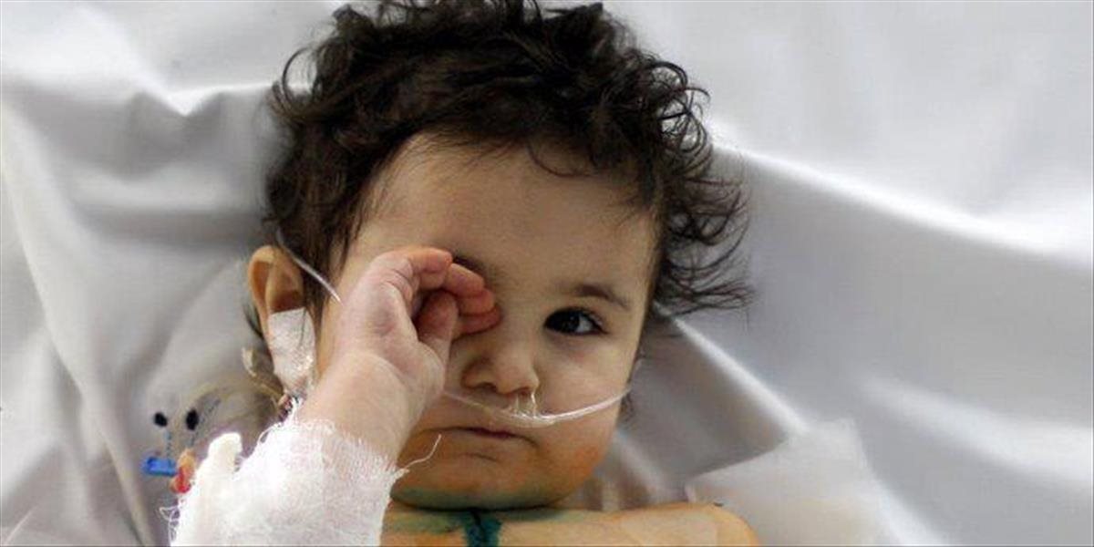 Rusko je pripravené pomôcť Ukrajine s detskou obrnou