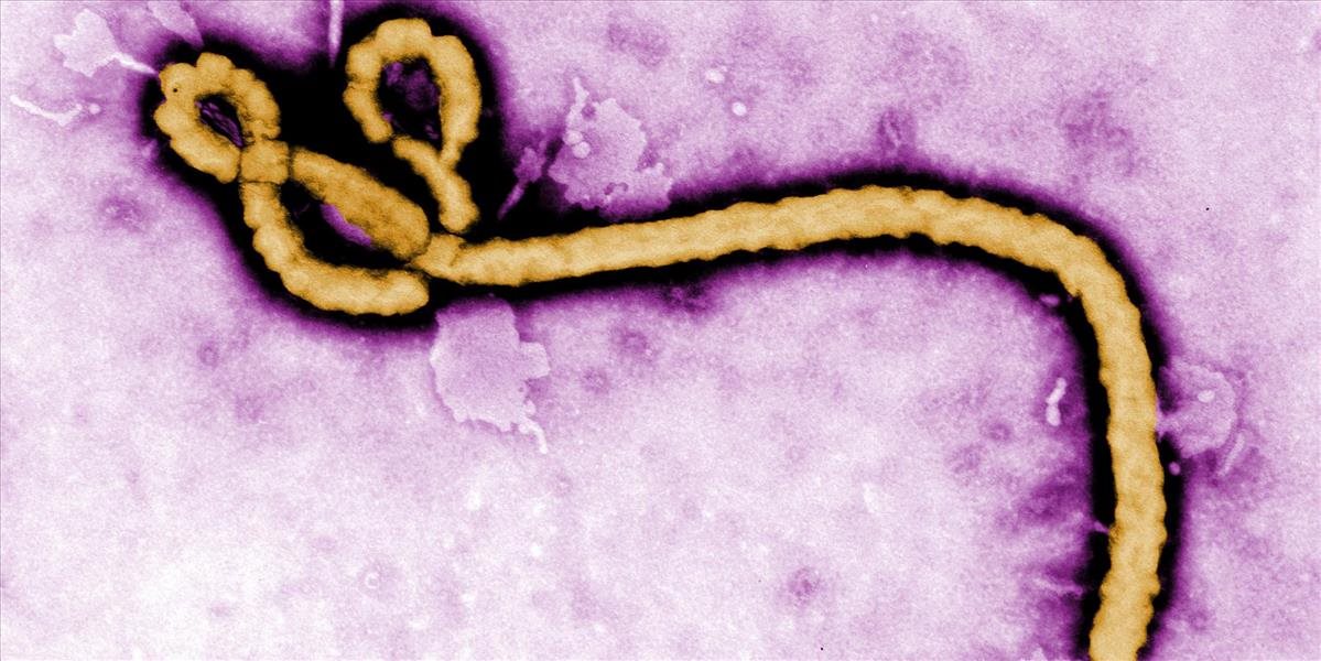 Vírus ebola ostáva v semene až deväť mesiacov od nákazy