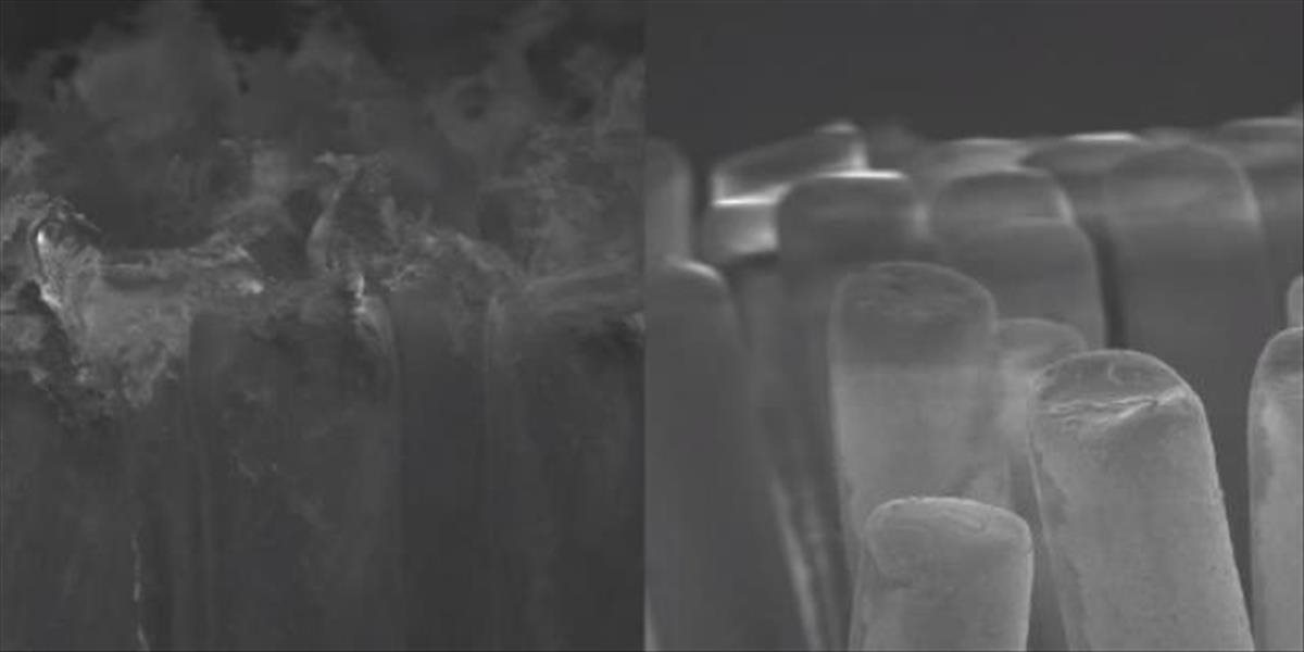 VIDEO Nová a stará zubná kefka pod elektrónovým mikroskopom