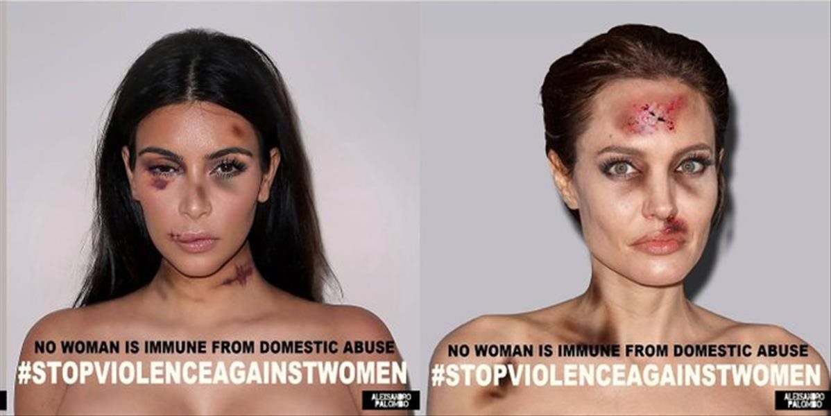 VIDEO a FOTO Domáce násilie? Angelina Jolie, Madonna a ďalšie celebrity ukázali krvavé modriny