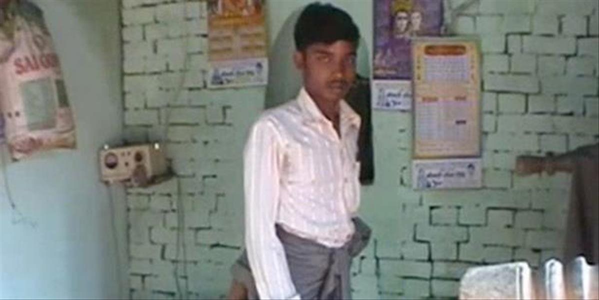 VIDEO Mladý Ind žije vo vyhnanstve, pre končatiny na chrbte ho ľudia označili za diabla