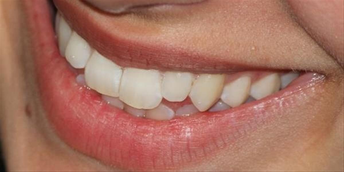 Prelom v medicíne: Vedci pestujú zuby zo zárodočných buniek, protézy môžu byť minulosťou