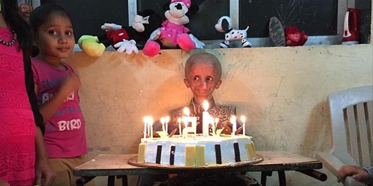 Chlapec uväznený v tele starca oslávil 15. narodeniny