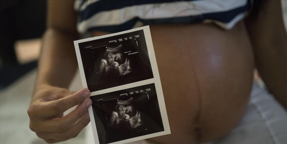 Ďalší prípad v Európe: Tehotnej žene diagnostikovali vírus zika
