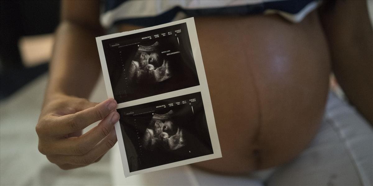 Vírusom zika je v Kolumbii nakazených vyše 3000 tehotných