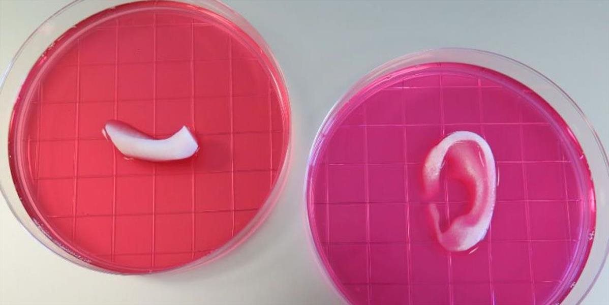 Revolúcia v zdravotníctve: Na 3D tlačiarni vytlačili ľudské ucho, ktoré je možné transplantovať!