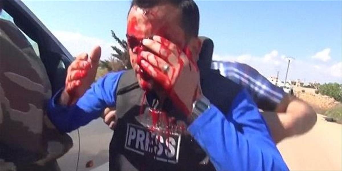 Krvavé VIDEO: Sýrskeho reportéra v priamom prenose zasiahol letecký útok