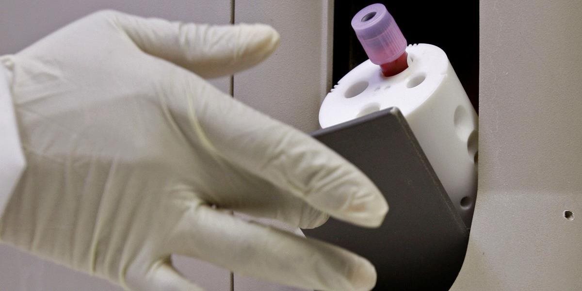 V Čechách polícia vyšetruje zámerné šírenie vírusu HIV
