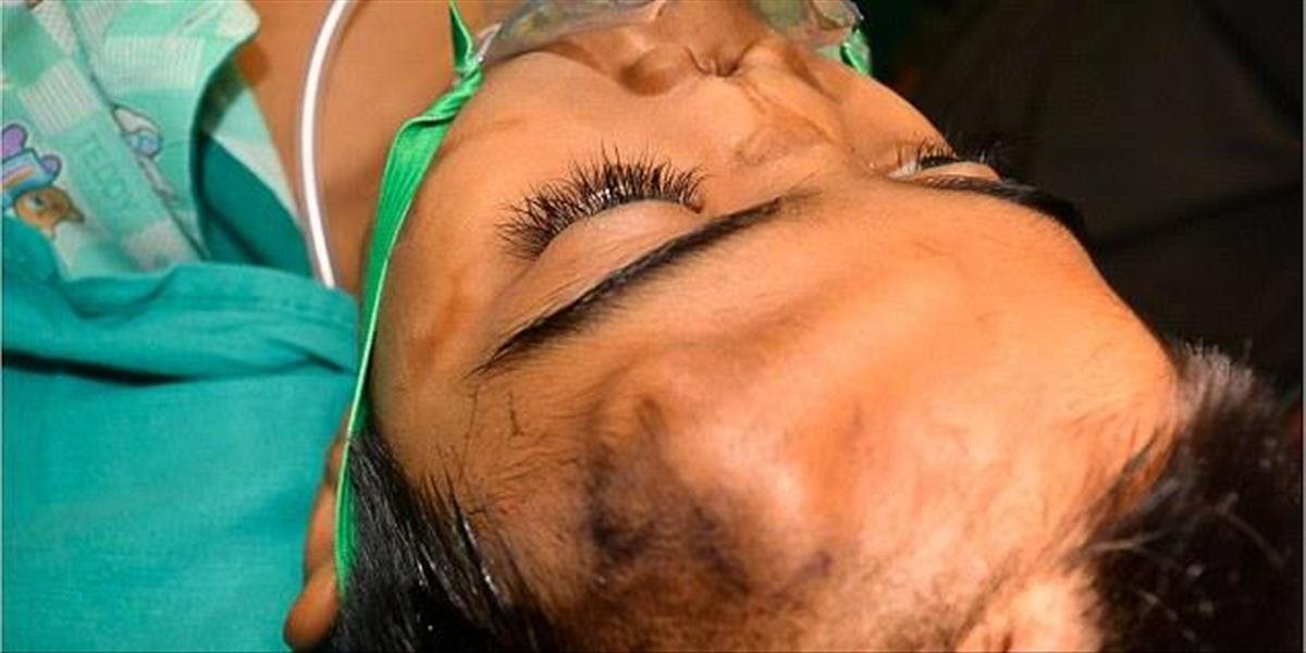 FOTO Indickému chlapcovi transplantovali nos, ktorý mu vypestovali na čele