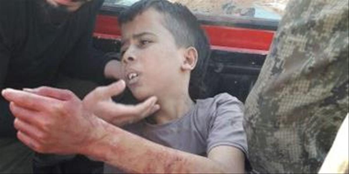 Otrasné VIDEO: Sýrski povstalci, ktorých podporujú Američania, odrezali hlavu dieťaťu