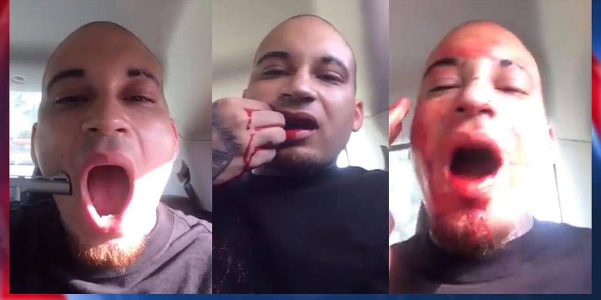 Choré VIDEO: Rapper sa sám strelil do tváre
