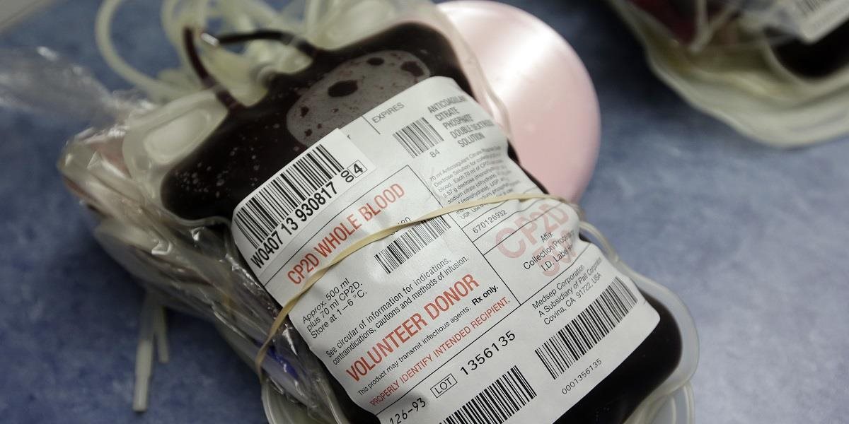 V krvi od darcov budú kontrolovať prítomnosť vírusu zika