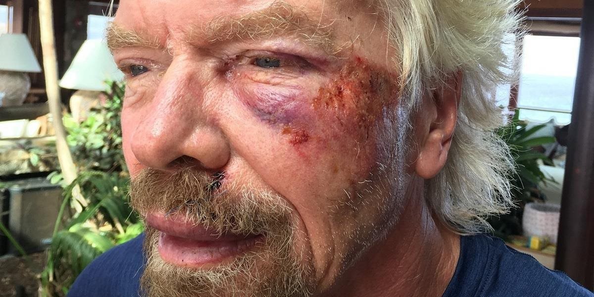 Miliardár Richard Branson si po páde z bicykla myslel, že zomrie