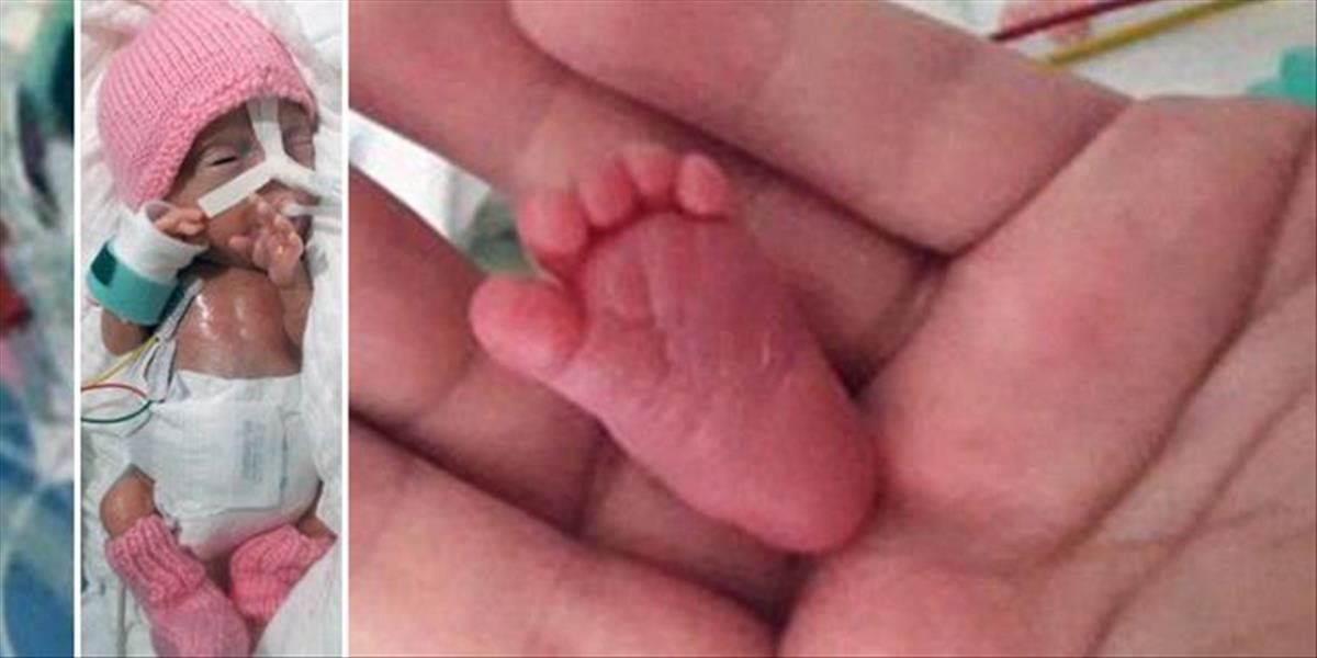 FOTO Toto je najmenšie predčasne narodené dieťa na svete, ktoré prežilo: Vážilo iba 227 gramov