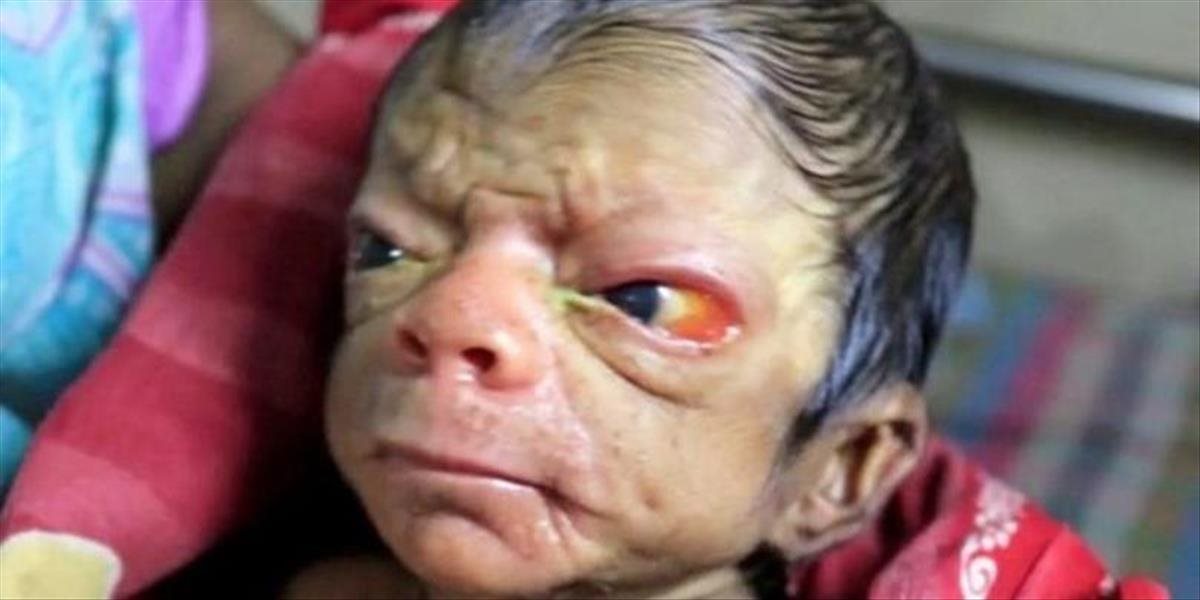 FOTO Ako z filmu Podivuhodný prípad Benjamina Buttona: Novorodenec vyzerá ako starček