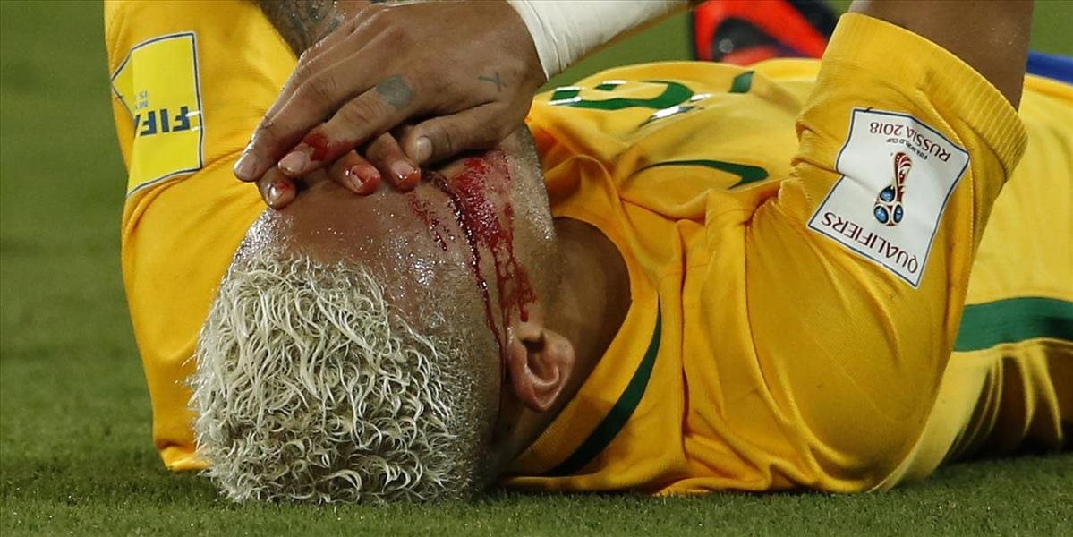 FOTO Neymar schytal tvrdý lakeť, jeho tvár zaliala krv