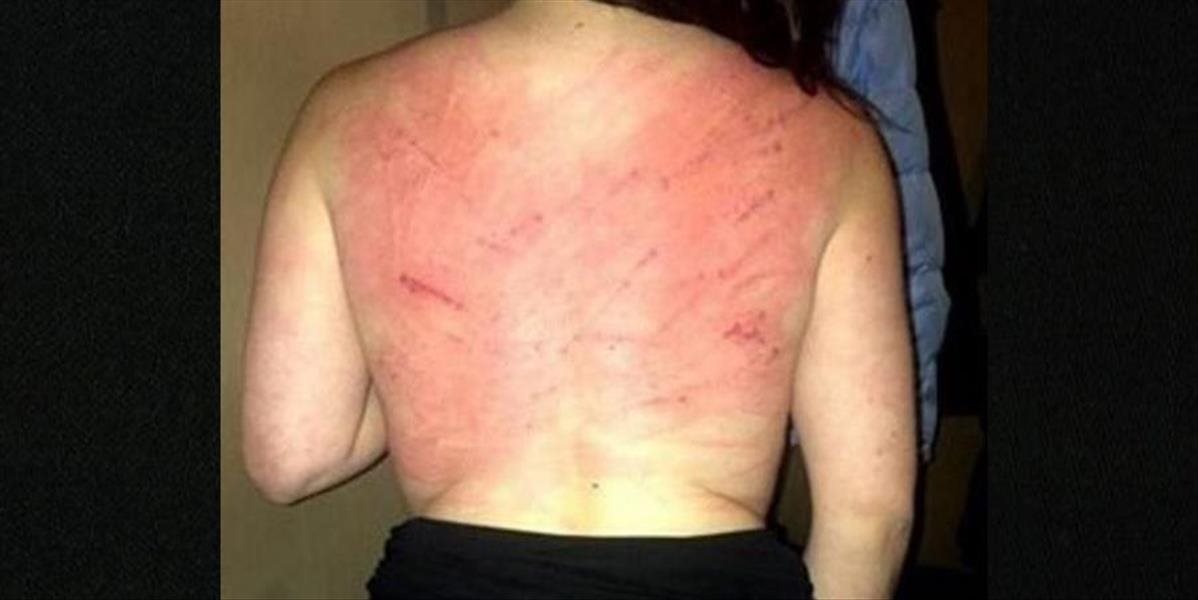 Mladá žena prehovorila o pekle v Iráne: 80 rán bičom za to, že bola na oslave kamaráta