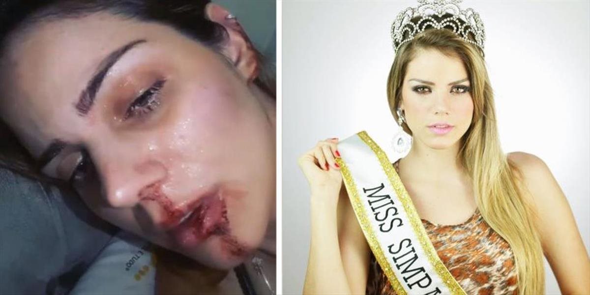 Zúfalé VIDEO Kráska v rukách netvora: Bývalú brazílsku Miss dobil do krvi jej ex-manžel