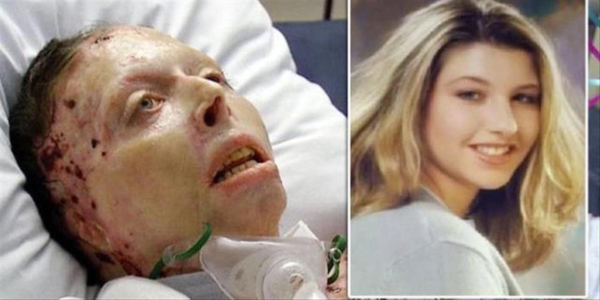 VIDEO Otrasný čin: Svoju priateľku chcel upáliť zaživa