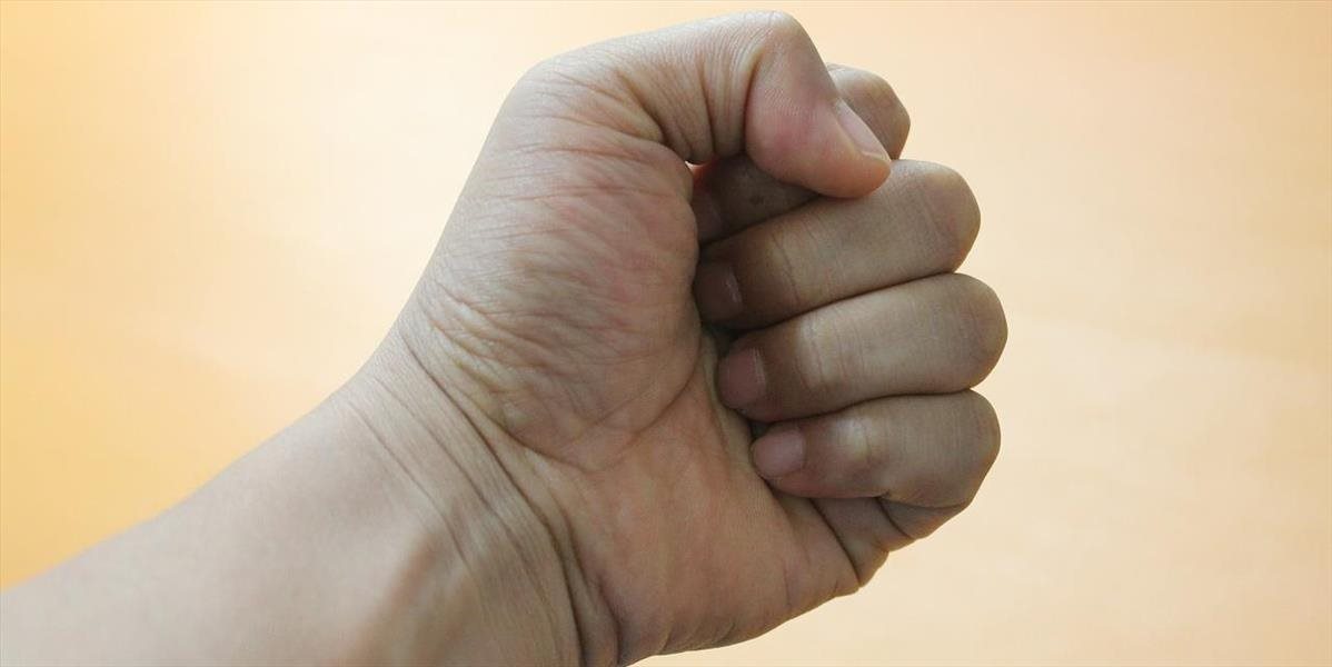 Jarmila z Novej Dubnice napadla svojho druha a zlomila mu nos, hrozí jej 12 rokov za mrežami