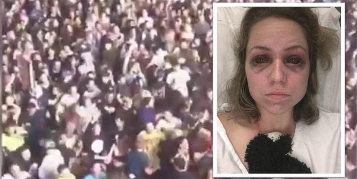 Festivalový horor: Žena takmer zomrela v tlačenici, po úraze jej sčerneli oči